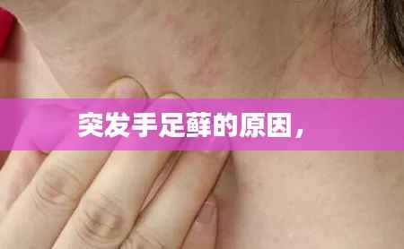 突发手足藓的原因,